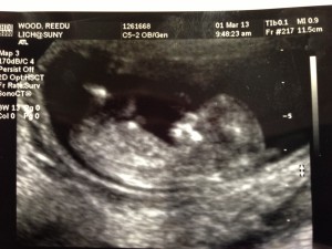 baby2