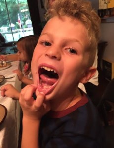 tooth2